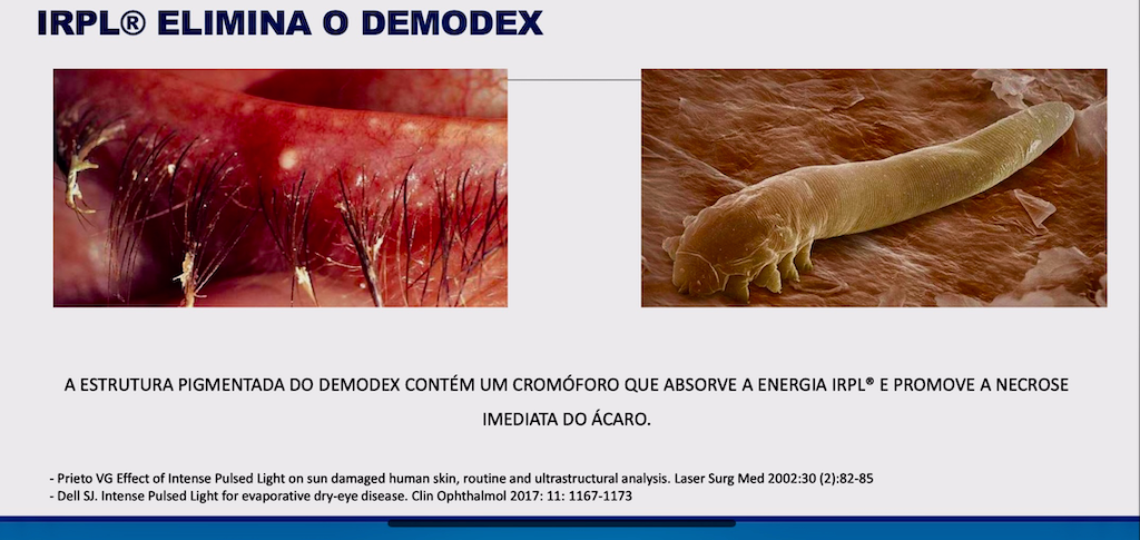 Controle de Demodex