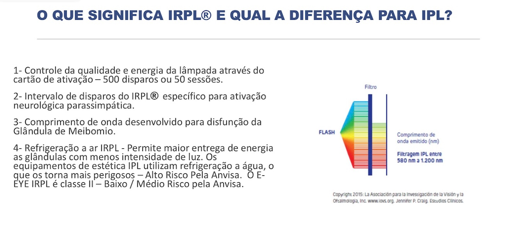 Comparativo IRPL vs IPL Convencional